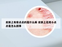 皮肤上有些点点的是什么癣 皮肤上出现小点点是怎么回事