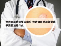 爸爸银屑病能要二胎吗 爸爸银屑病准备要孩子需要注意什么