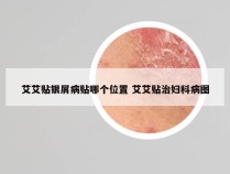艾艾贴银屑病贴哪个位置 艾艾贴治妇科病图