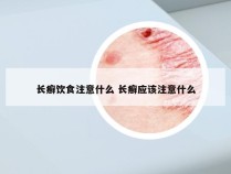 长癣饮食注意什么 长癣应该注意什么