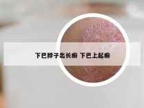 下巴脖子出长癣 下巴上起癣