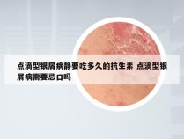 点滴型银屑病静要吃多久的抗生素 点滴型银屑病需要忌口吗