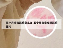 五个月宝宝起癣怎么办 五个月宝宝皮肤起癣图片