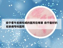 南宁看牛皮癣权威的医院在哪里 南宁最好的皮肤病专科医院