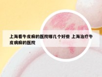 上海看牛皮癣的医院哪几个好些 上海治疗牛皮病癣的医院
