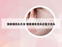 银屑病洗头方法 银屑病多洗头还是少洗头