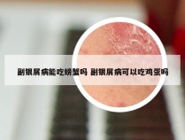 副银屑病能吃螃蟹吗 副银屑病可以吃鸡蛋吗