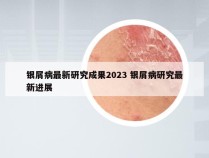 银屑病最新研究成果2023 银屑病研究最新进展