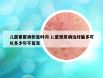 儿童银屑病恢复时间 儿童银屑病治好最多可以多少年不复发