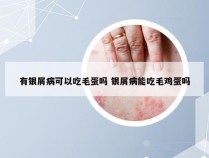 有银屑病可以吃毛蛋吗 银屑病能吃毛鸡蛋吗
