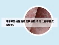 河北哪里的医院看皮肤病最好 河北省哪看皮肤病好?
