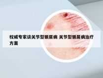 权威专家谈关节型银屑病 关节型银屑病治疗方案