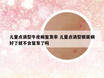 儿童点滴型牛皮癣复发率 儿童点滴型银屑病好了就不会复发了吗
