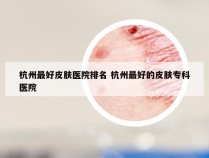 杭州最好皮肤医院排名 杭州最好的皮肤专科医院