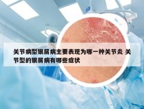 关节病型银屑病主要表现为哪一种关节炎 关节型的银屑病有哪些症状