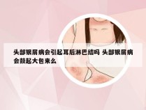 头部银屑病会引起耳后淋巴结吗 头部银屑病会鼓起大包来么