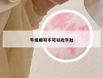牛皮癣可不可以吃牛肚