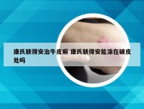 康氏肤得安治牛皮癣 康氏肤得安能涂在破皮处吗
