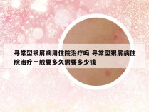寻常型银屑病用住院治疗吗 寻常型银屑病住院治疗一般要多久需要多少钱