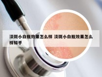 淡斑小白瓶效果怎么样 淡斑小白瓶效果怎么样知乎