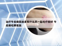 治疗牛皮癣氨肽素和什么药一起吃疗胶好 牛皮癣吃脾氨肽