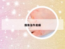 我有治牛皮癣