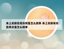 身上皮肤出现白斑是怎么回事 身上皮肤有白色斑点是怎么回事