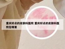 重庆好点的皮肤科医院 重庆好点的皮肤科医院在哪里