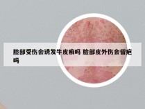 脸部受伤会诱发牛皮癣吗 脸部皮外伤会留疤吗