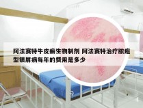 阿法赛特牛皮癣生物制剂 阿法赛特治疗脓疱型银屑病每年的费用是多少