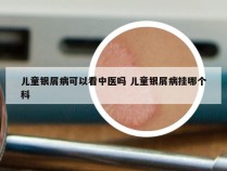 儿童银屑病可以看中医吗 儿童银屑病挂哪个科