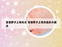 宝宝脖子上有白点 宝宝脖子上有白色的小圆点