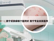 西宁皮肤癣哪个医院好 西宁专业皮肤医院