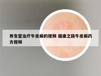 养生堂治疗牛皮癣的视频 健康之路牛皮癣药方视频