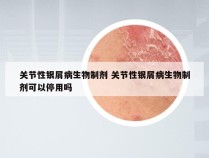 关节性银屑病生物制剂 关节性银屑病生物制剂可以停用吗