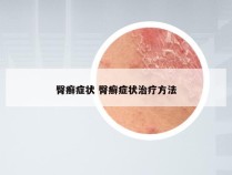 臀癣症状 臀癣症状治疗方法