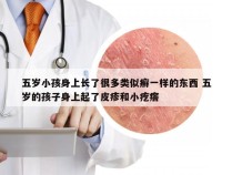 五岁小孩身上长了很多类似癣一样的东西 五岁的孩子身上起了皮疹和小疙瘩