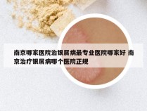 南京哪家医院治银屑病最专业医院哪家好 南京治疗银屑病哪个医院正规