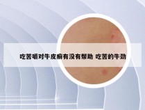 吃苦嚼对牛皮癣有没有帮助 吃苦的牛劲