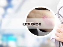 北欧牛皮癣患者