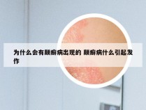 为什么会有颠癣病出现的 颠癣病什么引起发作