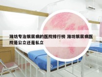潍坊专治银屑病的医院排行榜 潍坊银屑病医院是公立还是私立
