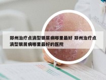 郑州治疗点滴型银屑病哪里最好 郑州治疗点滴型银屑病哪里最好的医院
