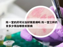 陈一堂的药可以治好银屑病吗 陈一堂三种药膏多少钱治哪些皮肤病