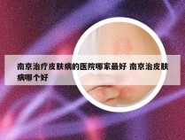 南京治疗皮肤病的医院哪家最好 南京治皮肤病哪个好