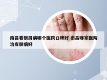南昌看银屑病哪个医院口碑好 南昌哪家医院治皮肤病好