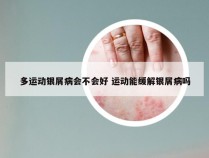 多运动银屑病会不会好 运动能缓解银屑病吗