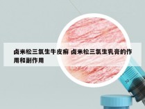 卤米松三氯生牛皮癣 卤米松三氯生乳膏的作用和副作用