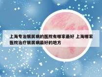 上海专治银屑病的医院有哪家最好 上海哪家医院治疗银屑病最好的地方