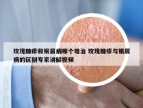 玫瑰糠疹和银屑病哪个难治 玫瑰糠疹与银屑病的区别专家讲解视频